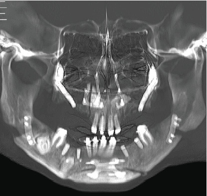 Figure 6