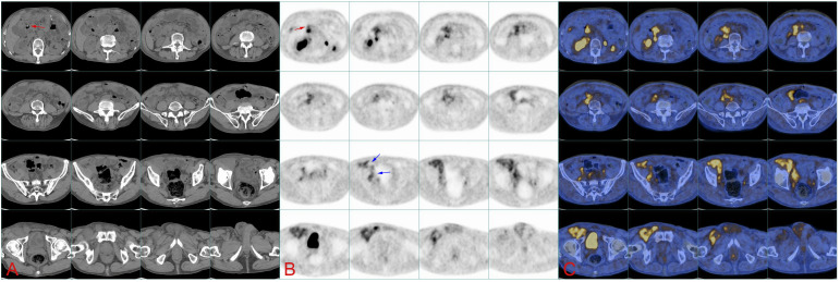 Figure 2