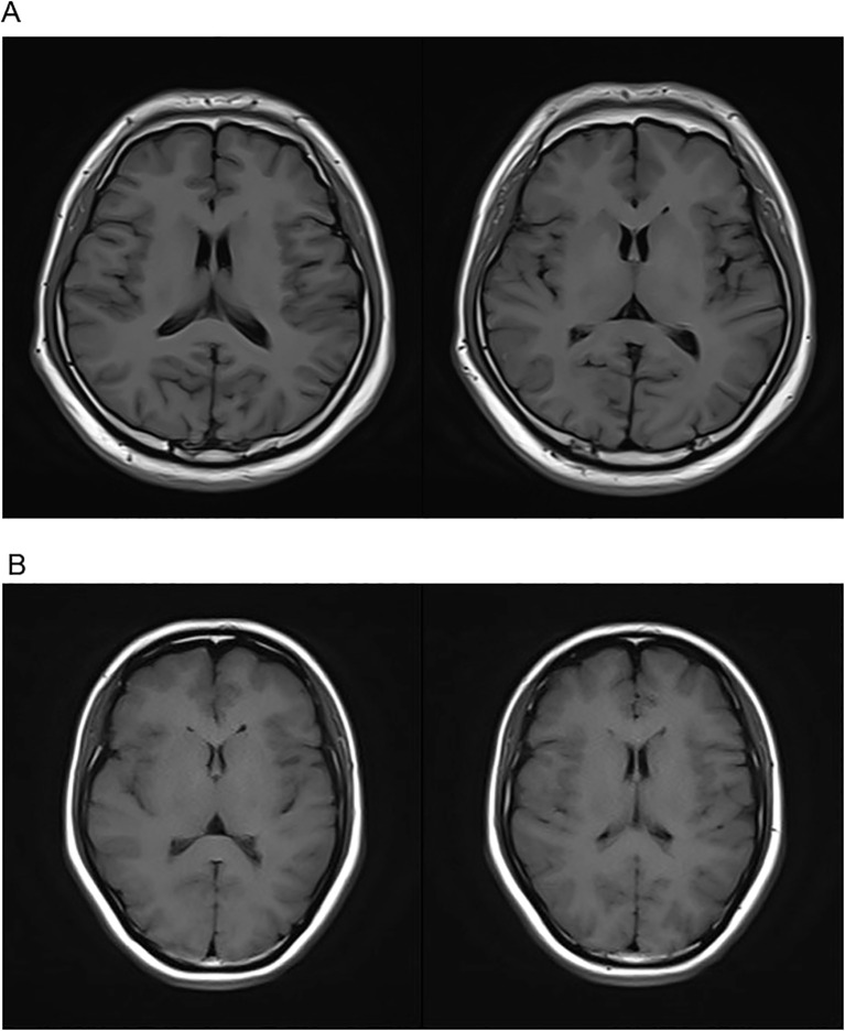Figure 3