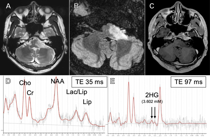 Figure 1