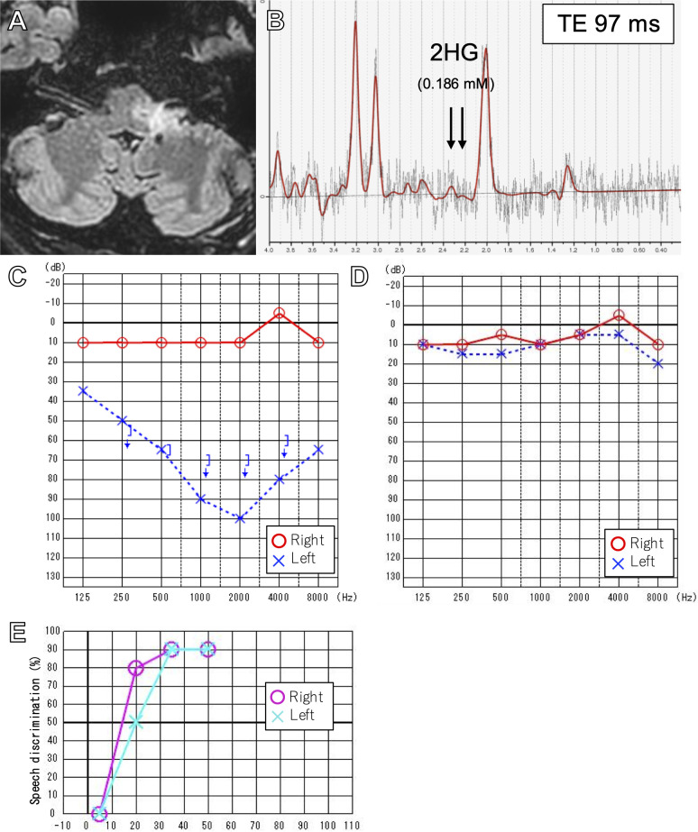 Figure 3