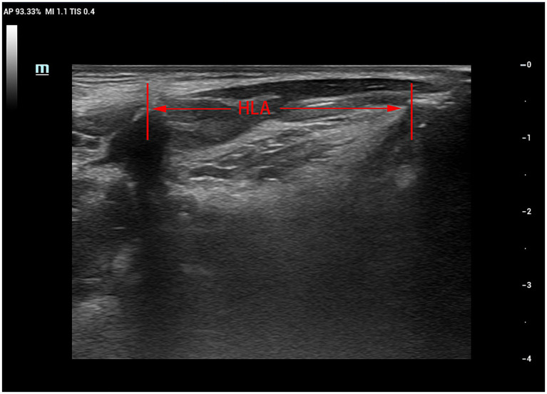 Figure 9