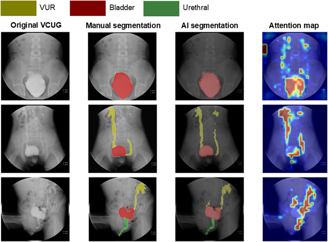 Fig. 4