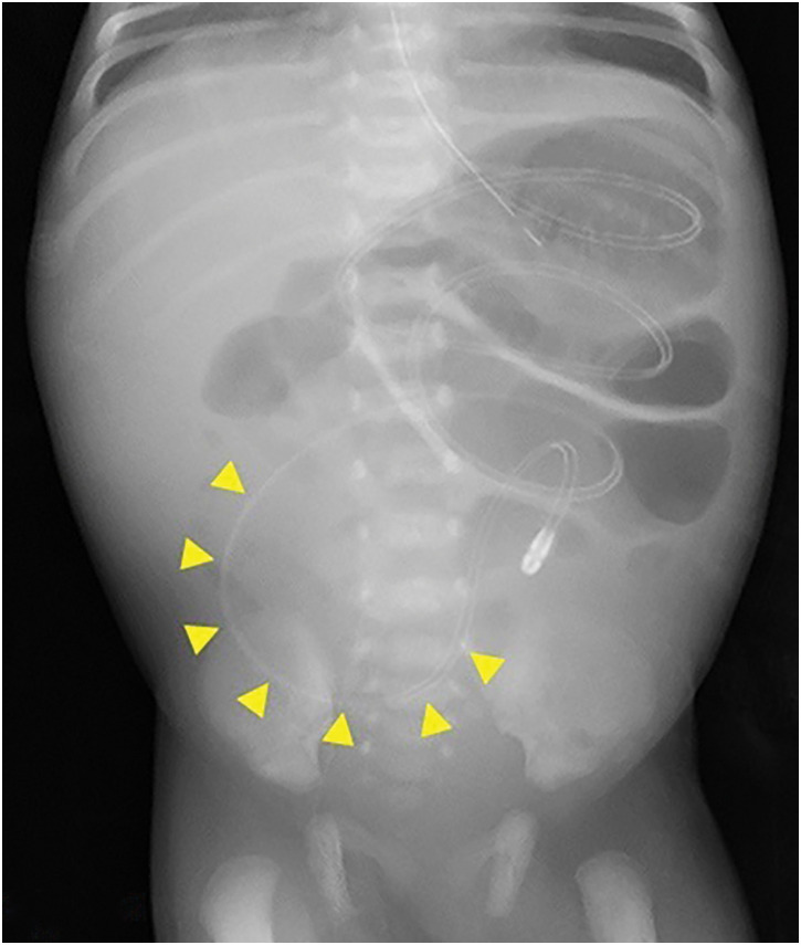 Fig. 1