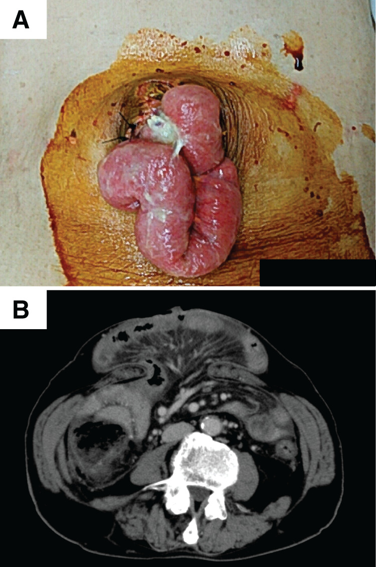 Fig. 1