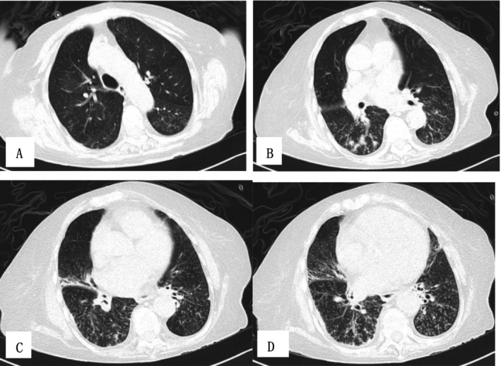 FIGURE 2
