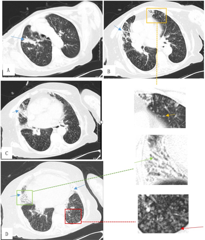 FIGURE 1