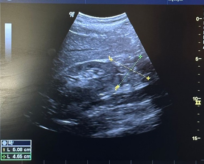 Fig. 3