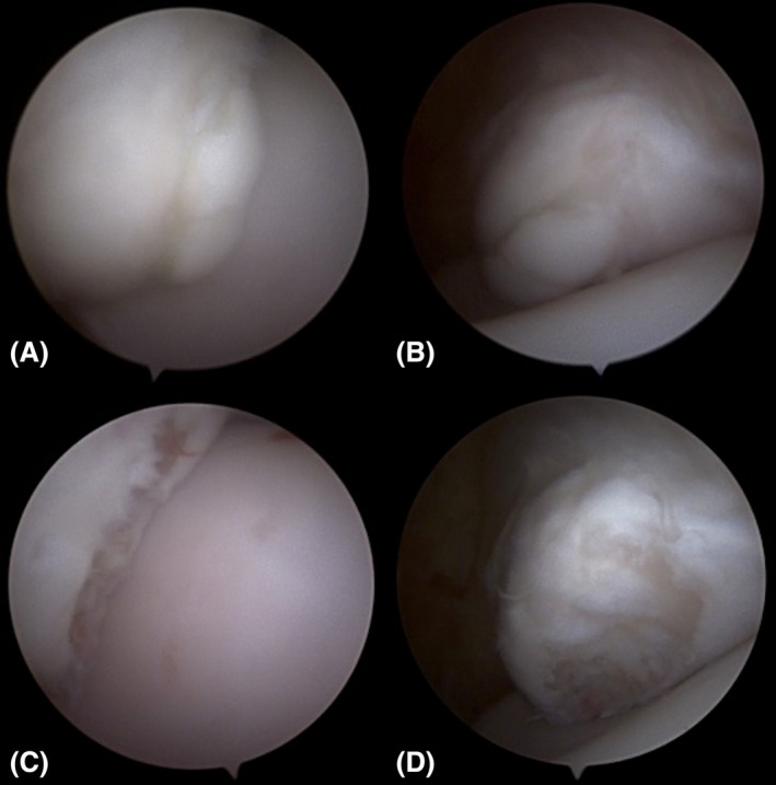 FIGURE 3