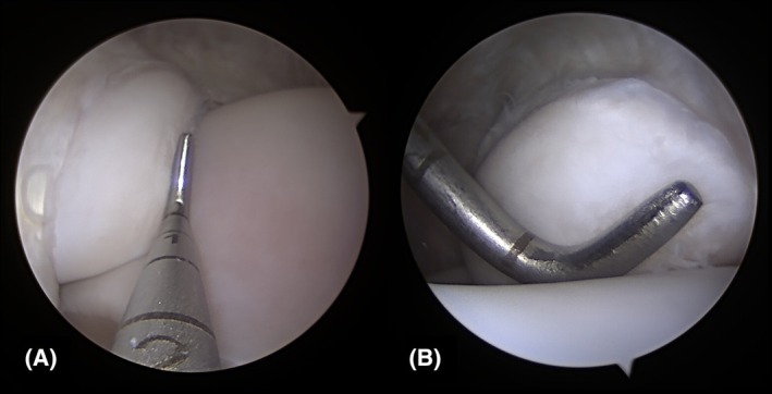 FIGURE 2