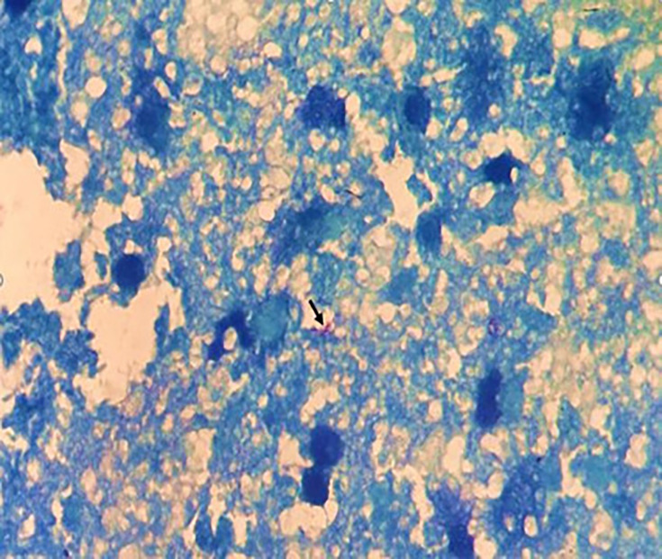 Fig. 2