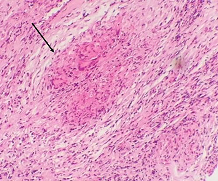 Fig. 4