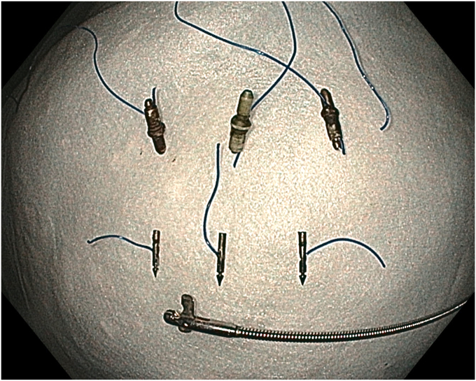 Figure 7