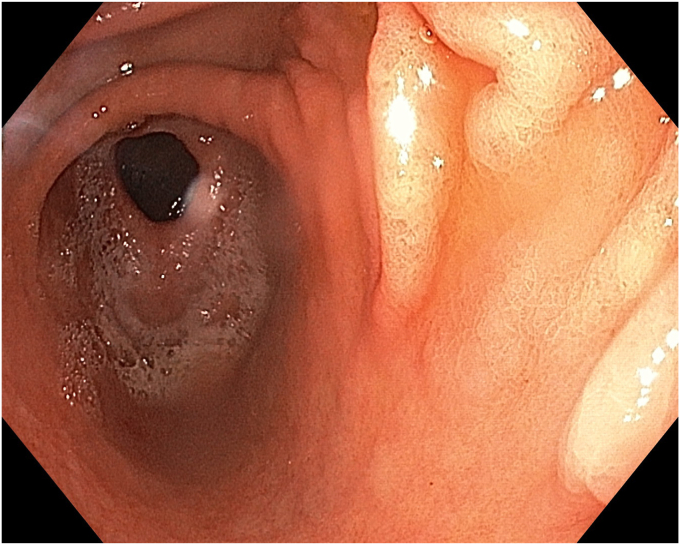 Figure 9