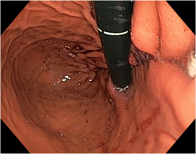 Figure 14