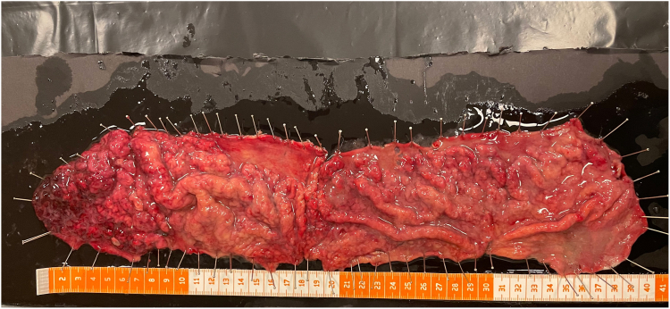 Figure 15