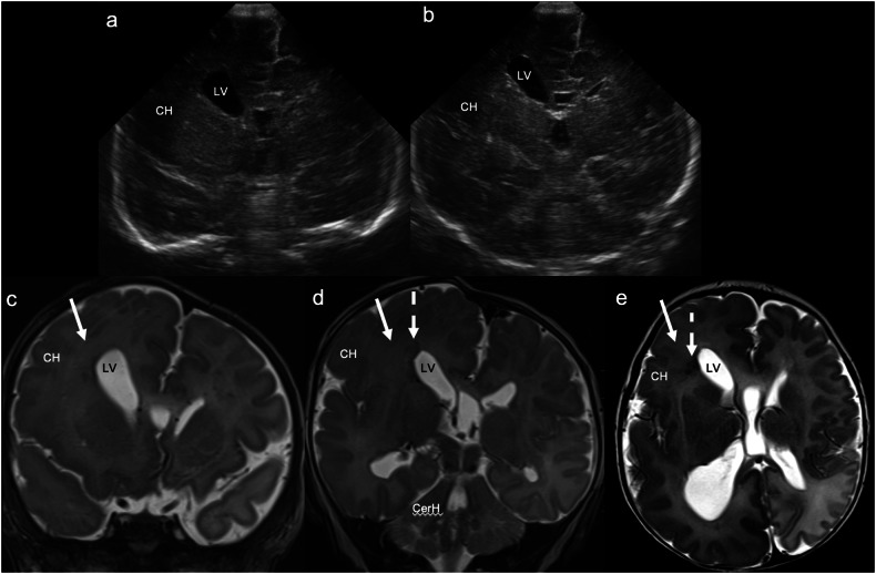 Figure 11