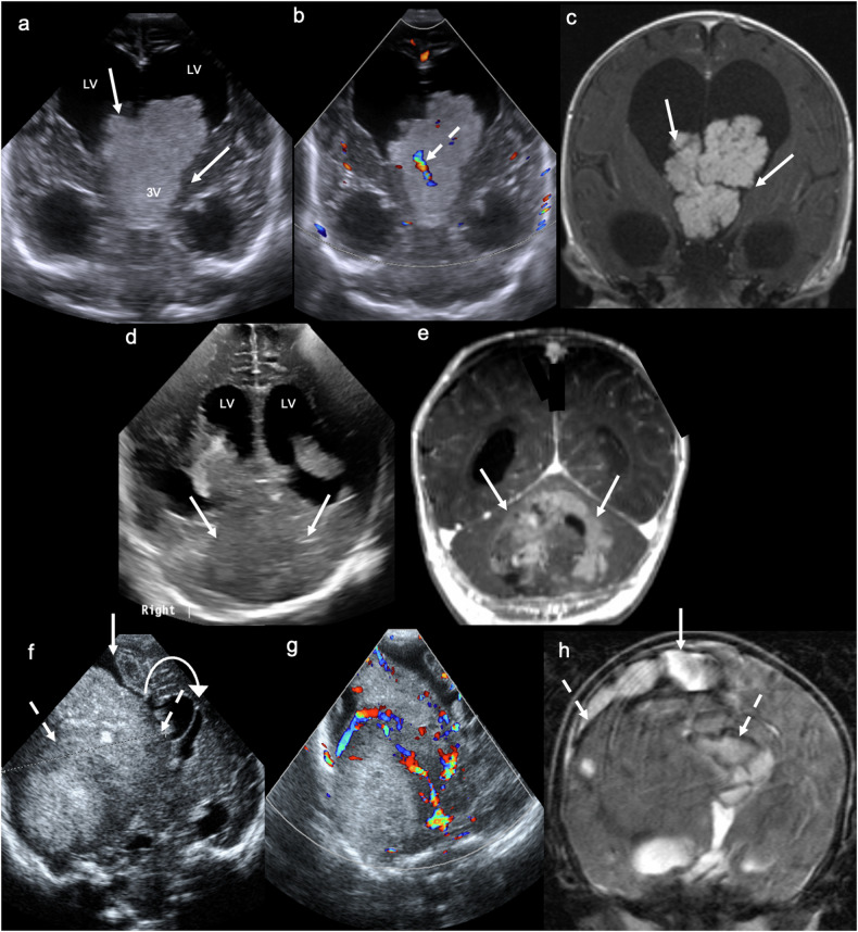 Figure 12