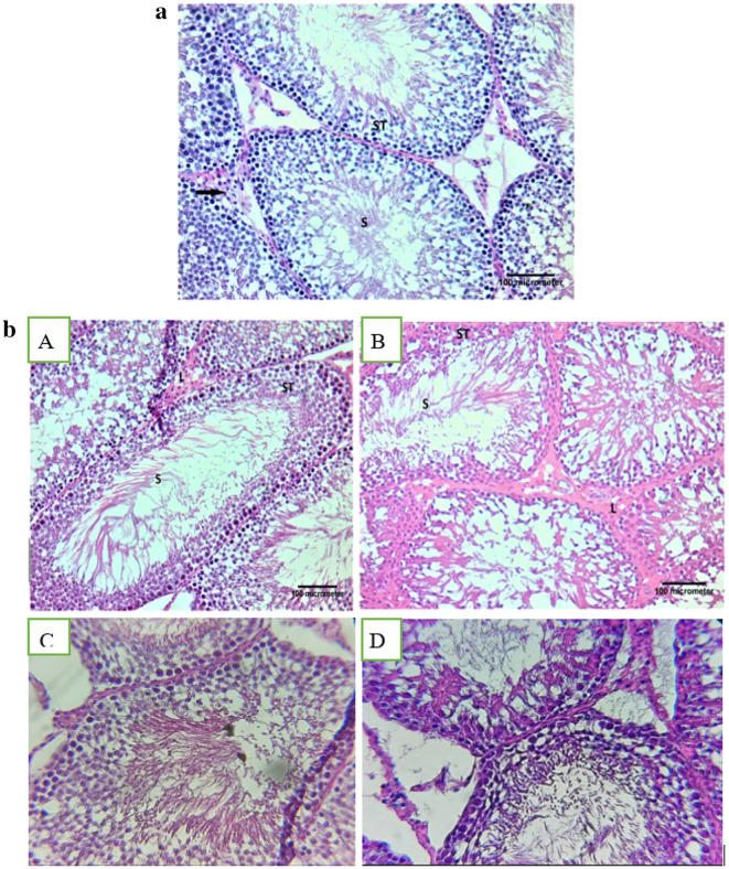 Figure 12