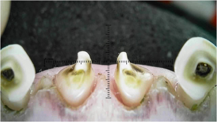 Figure 12