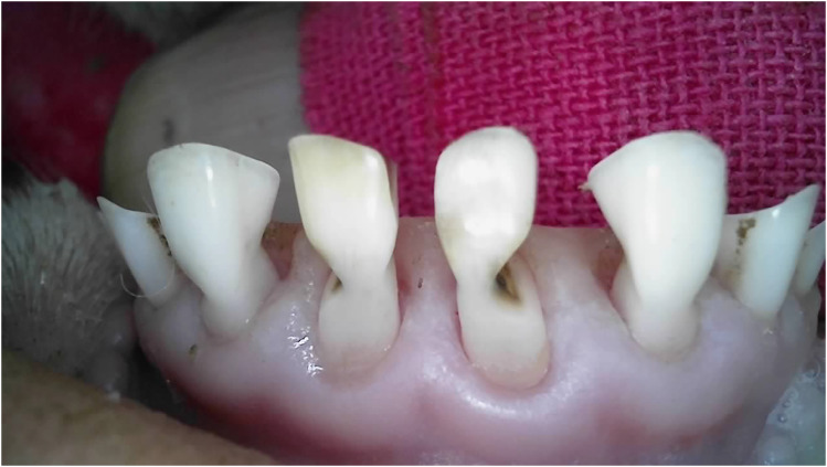 Figure 14