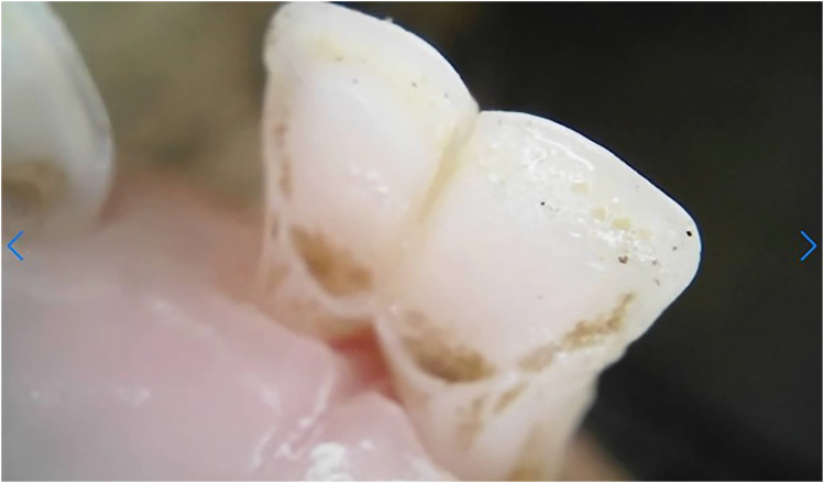 Figure 18