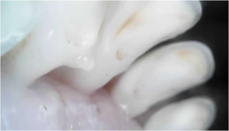 Figure 19