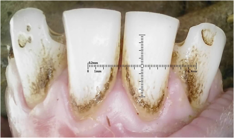Figure 21