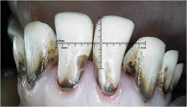 Figure 22