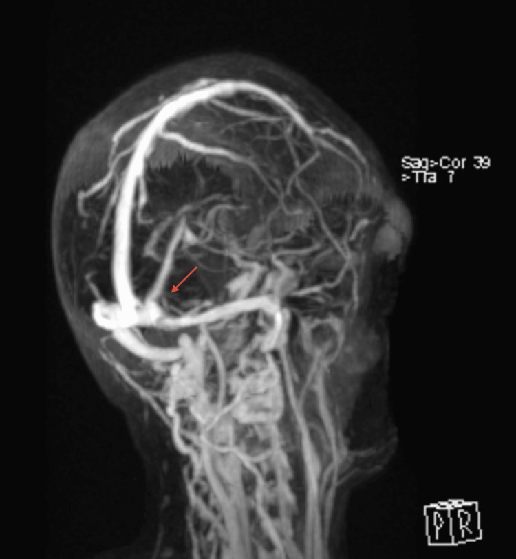 Figure 7