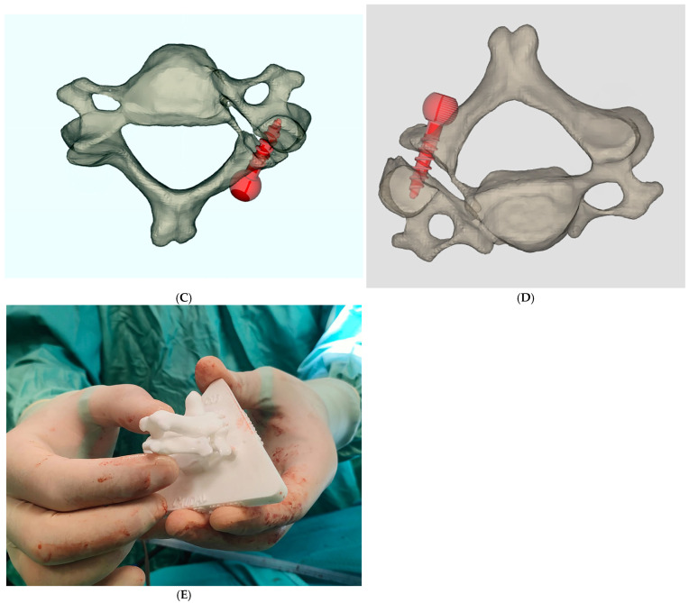 Figure 4