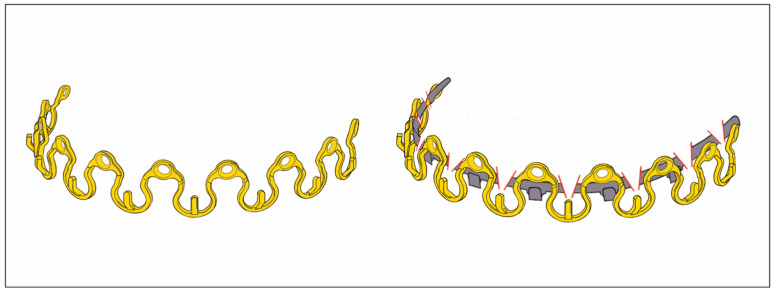 Figure 14