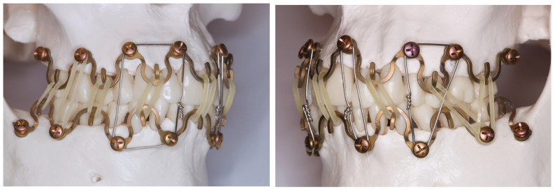Figure 17
