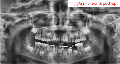 Figure 10