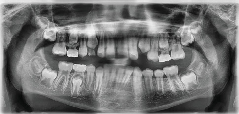 Figure 11