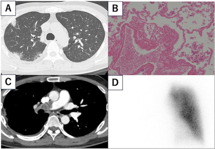 FIGURE 1