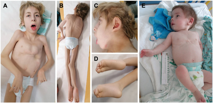 FIGURE 3