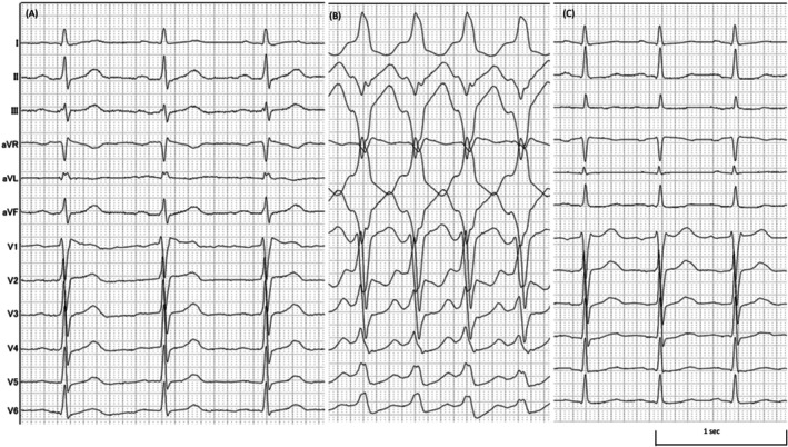FIGURE 1