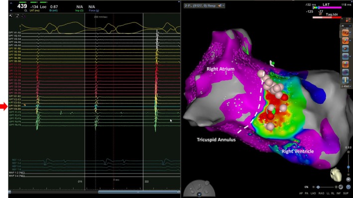 FIGURE 3