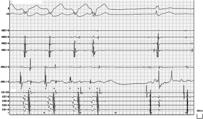 FIGURE 4