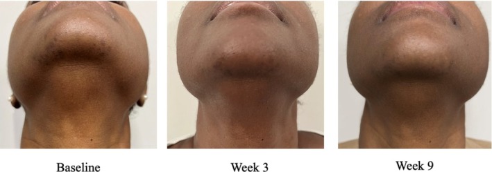 FIGURE 7
