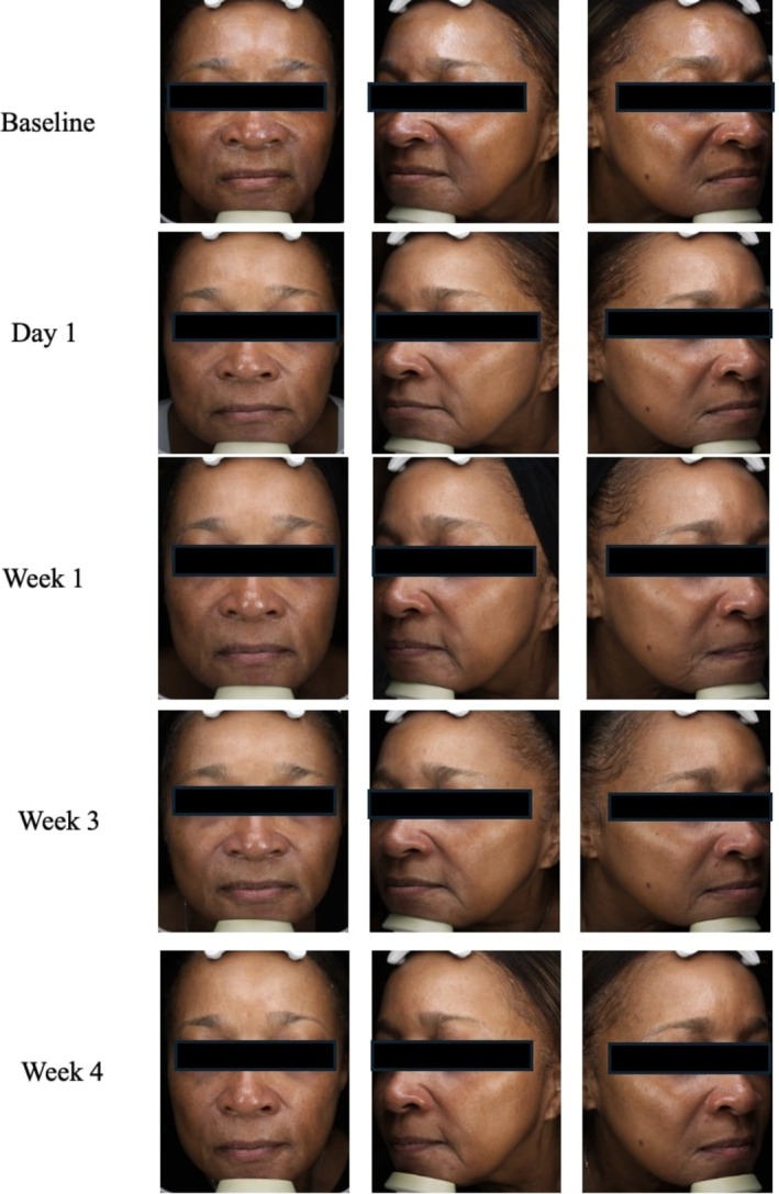 FIGURE 3