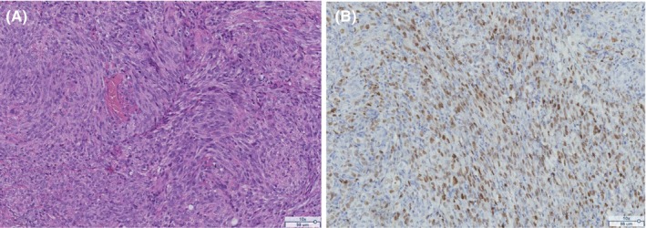 FIGURE 2