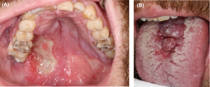 FIGURE 1