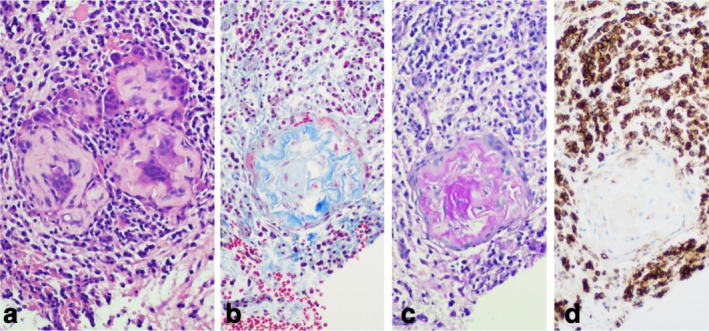 FIGURE 1