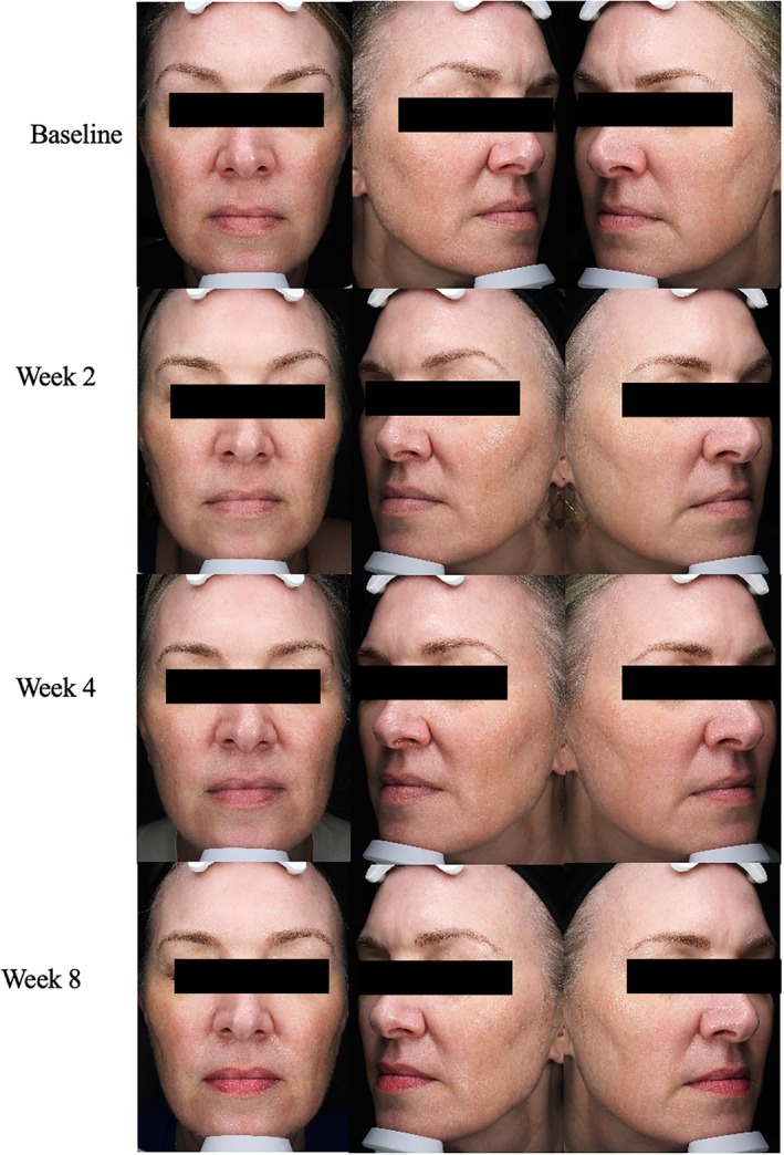 FIGURE 1