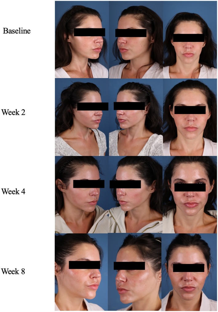FIGURE 7