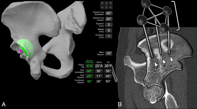 Figure 19