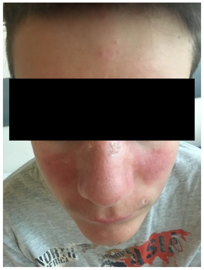 Figure 1