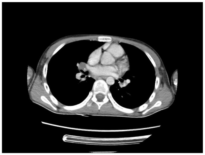 Figure 9